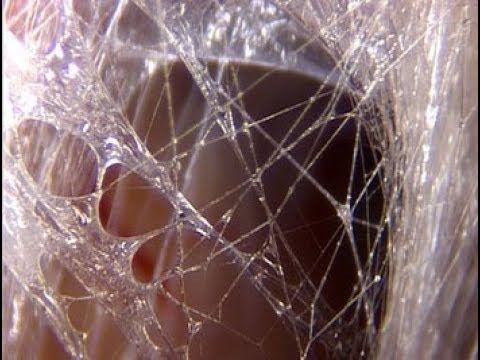 Watch “What is Fascia?” by ABR Therapy on YouTube, opens in a new tab